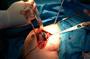 جراحی نادر تعویض مفصل شانه در بیمارستان شهید بهشتی بابل